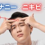 オナニーとニキビの関係性!オナニキビの原因と対策を解説
